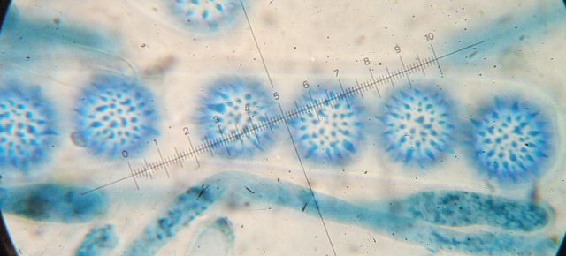 macrostoma