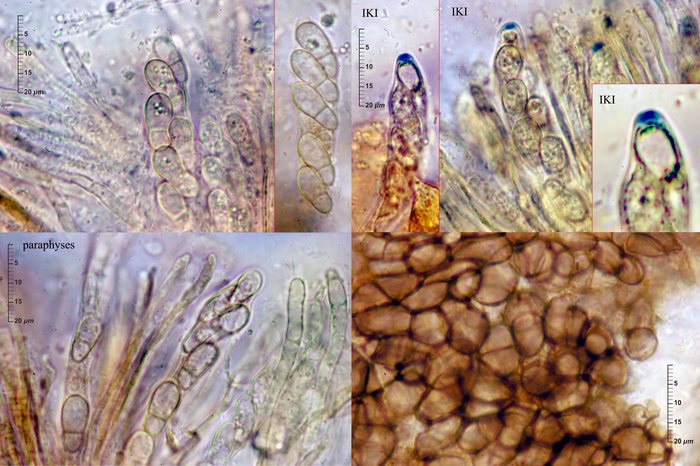 macrostoma