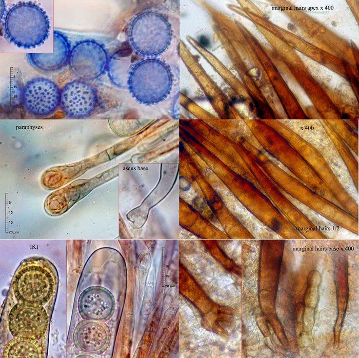 macrostoma