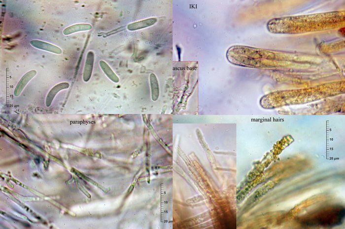 macrostoma