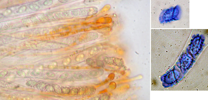 macrostoma