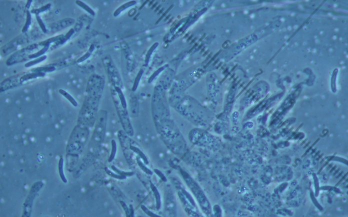 macrostoma