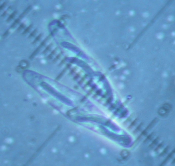 macrostoma