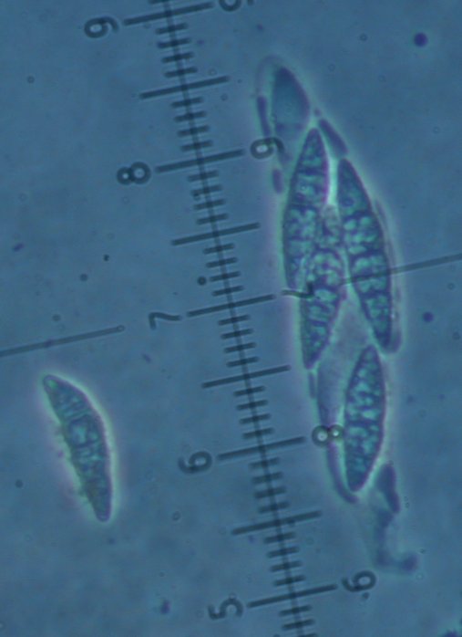 macrostoma
