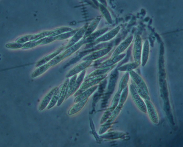macrostoma