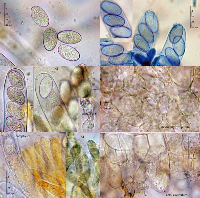 macrostoma