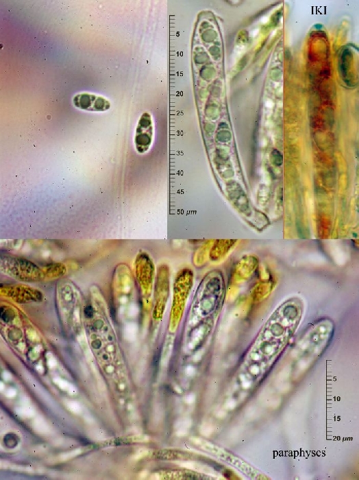 macrostoma