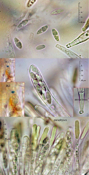 macrostoma