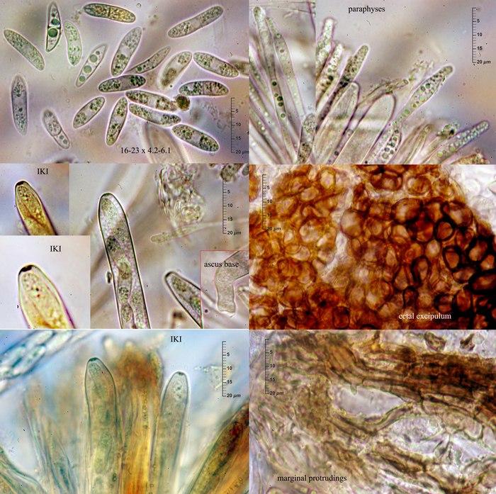 macrostoma