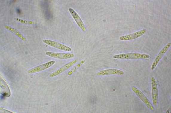 macrostoma