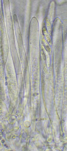 macrostoma