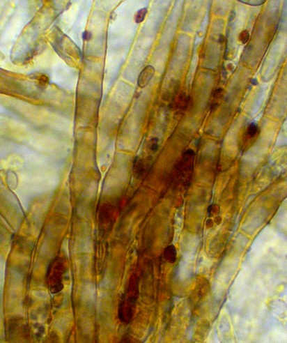 macrostoma