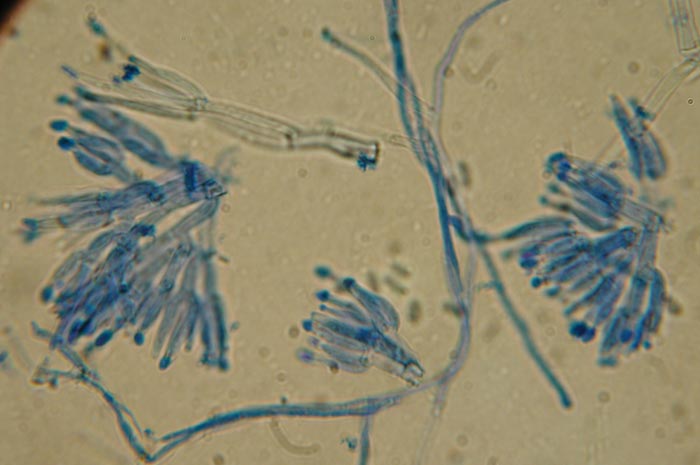 macrostoma