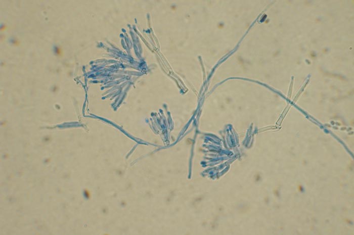 macrostoma
