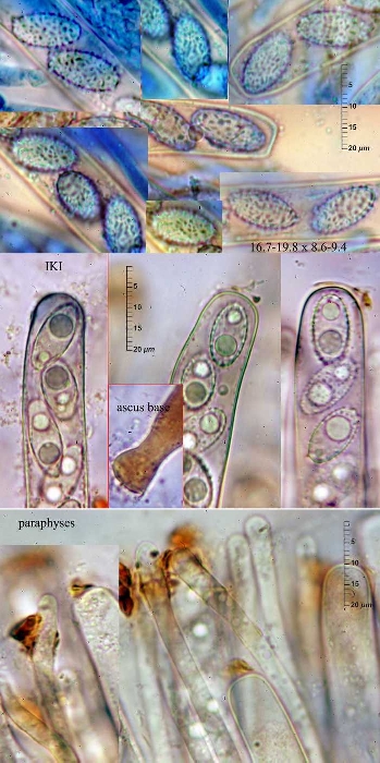 macrostoma