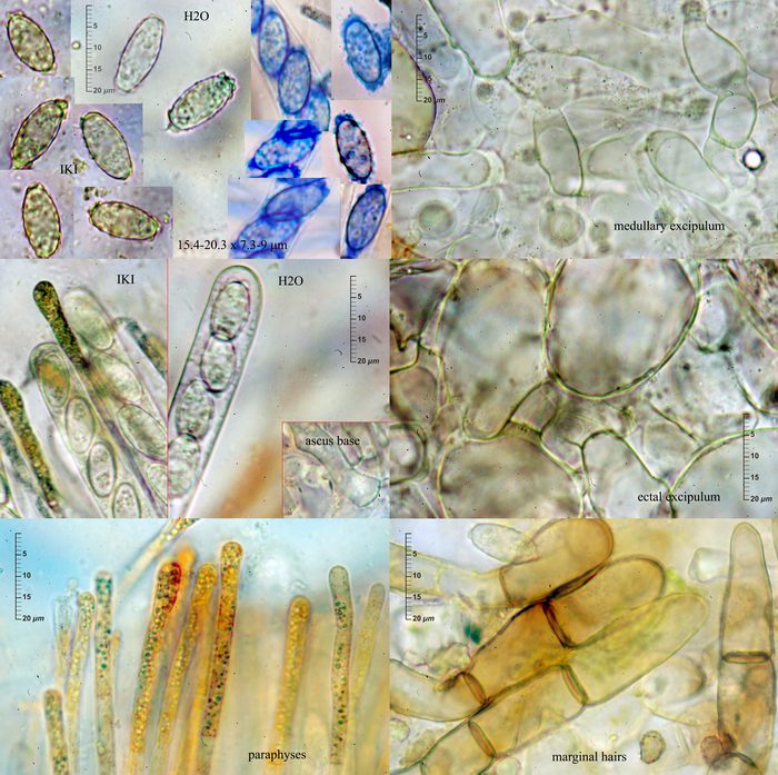 macrostoma