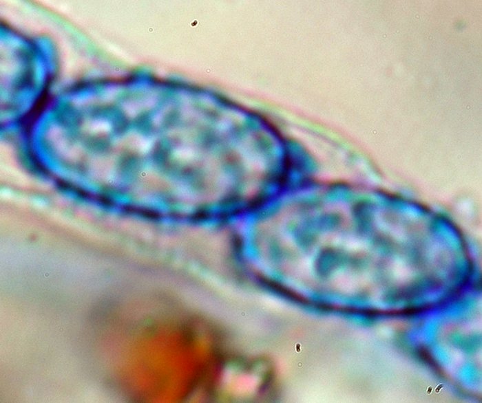 macrostoma