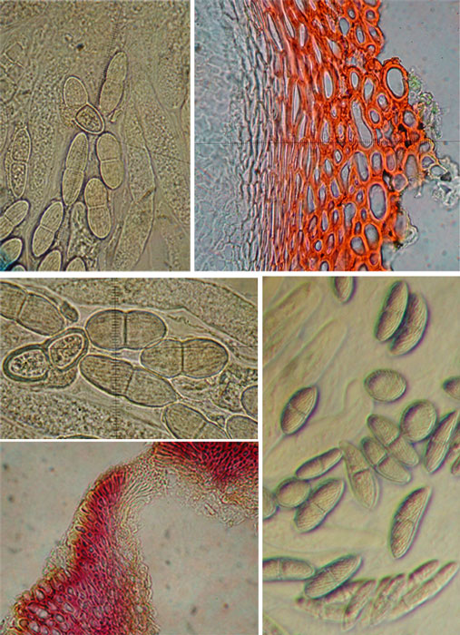 macrostoma