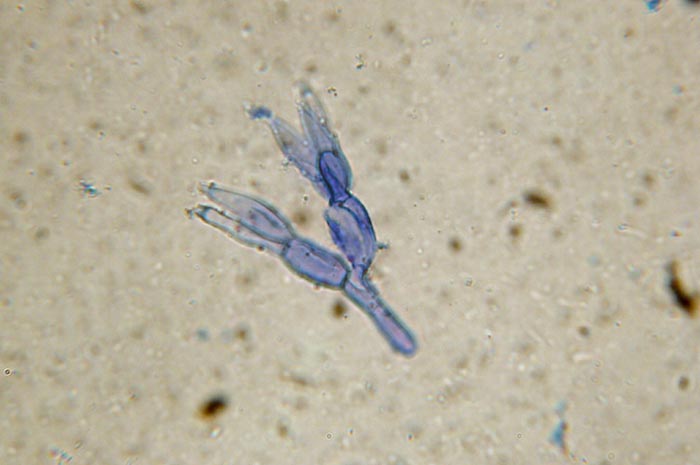 macrostoma