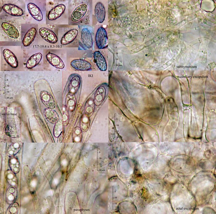 macrostoma