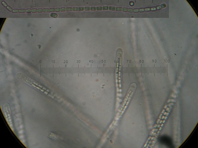 macrostoma