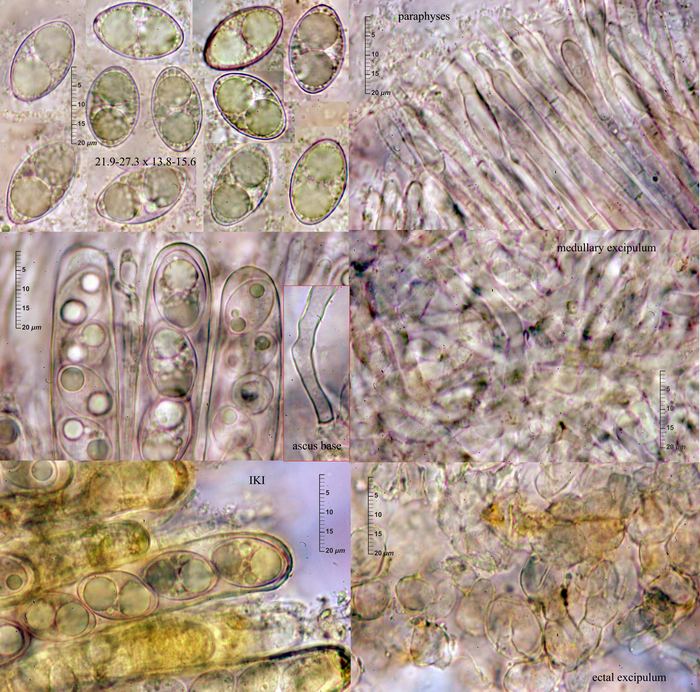 macrostoma