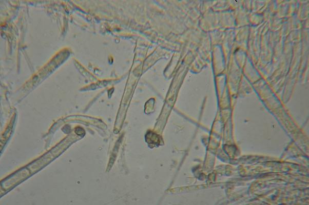 macrostoma