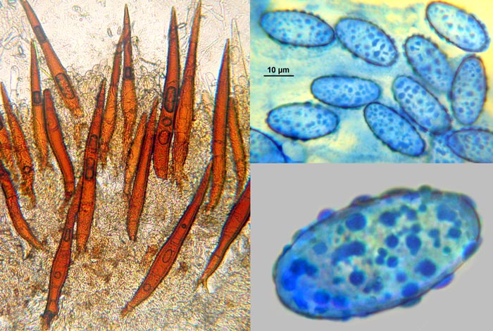 macrostoma