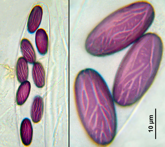 macrostoma
