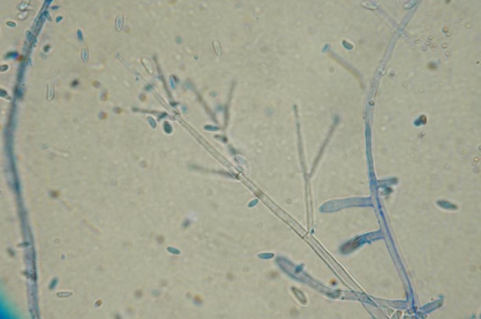 macrostoma