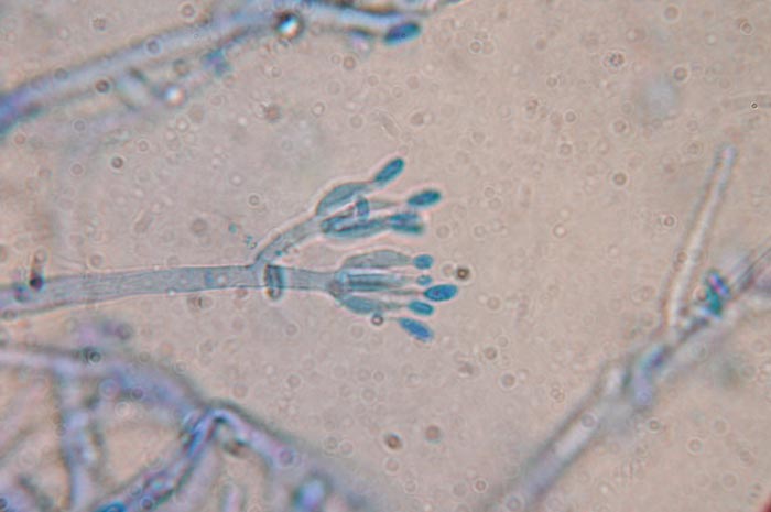 macrostoma