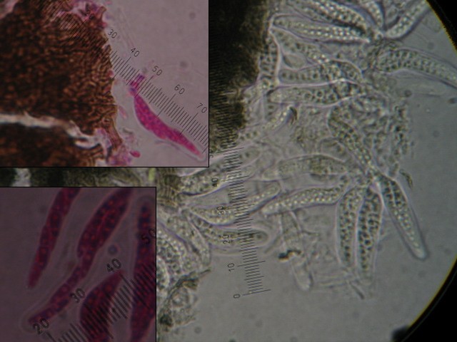 macrostoma