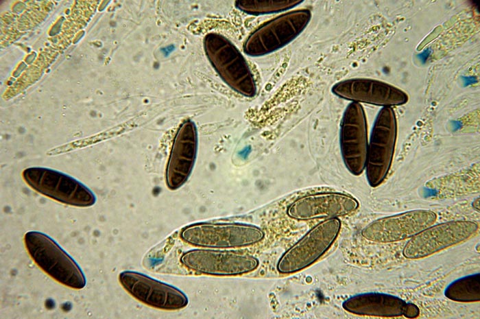 macrostoma