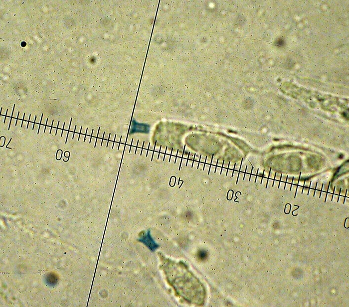 macrostoma