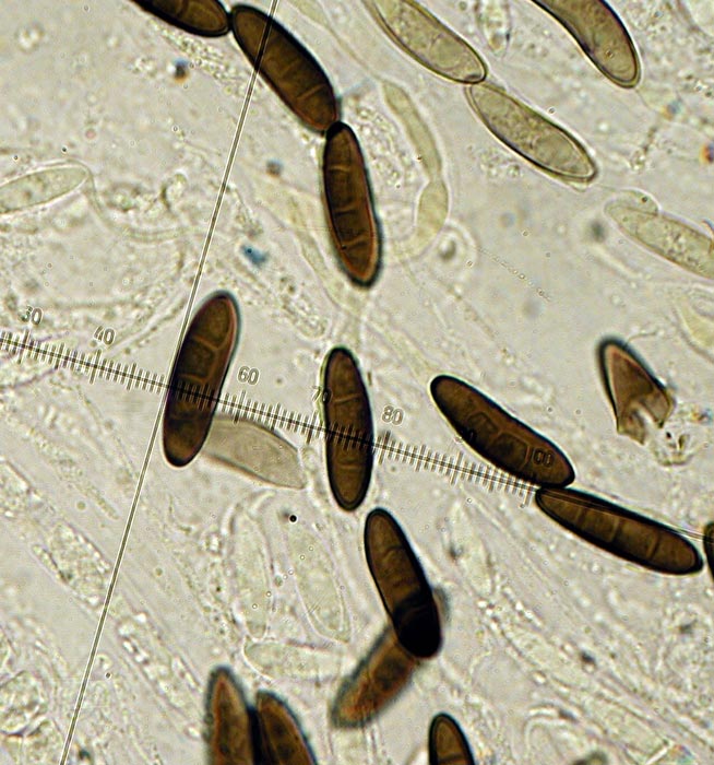 macrostoma