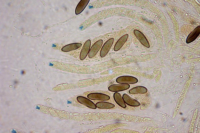 macrostoma