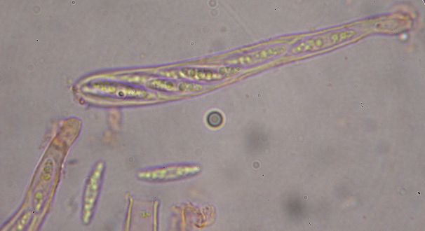 macrostoma