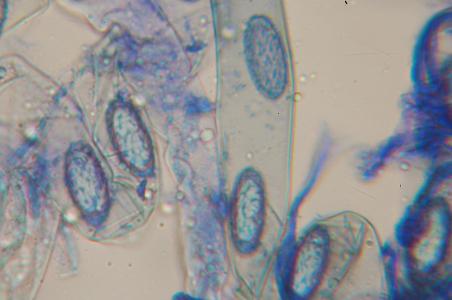macrostoma