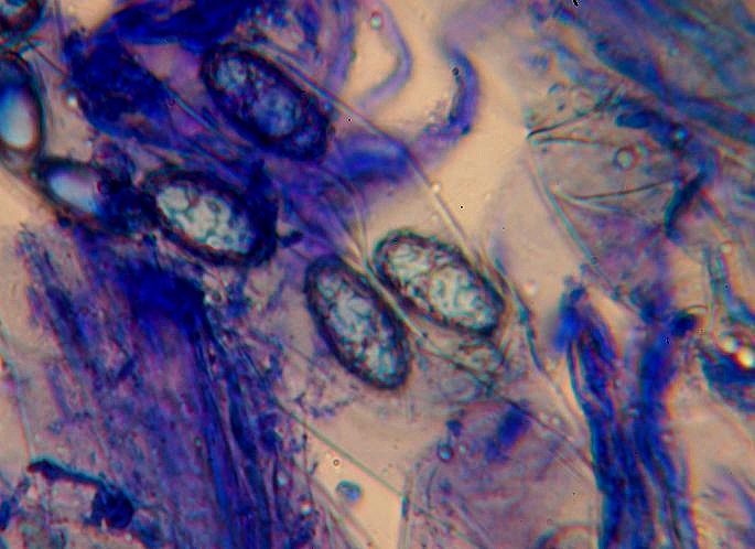 macrostoma