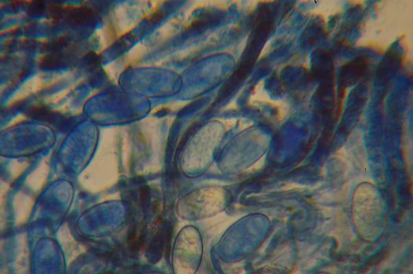 macrostoma