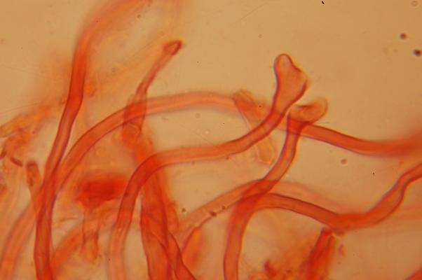 macrostoma