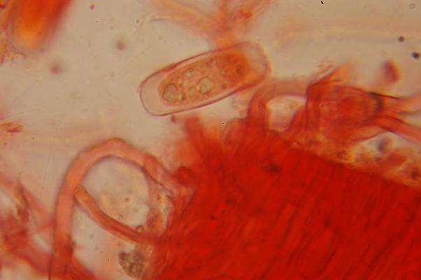 macrostoma