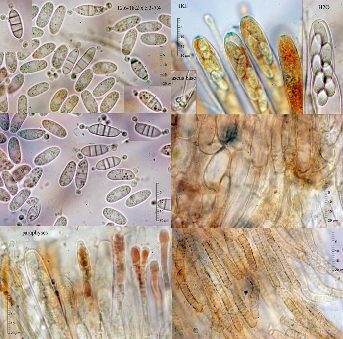 macrostoma