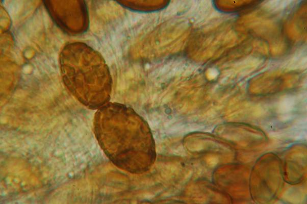macrostoma