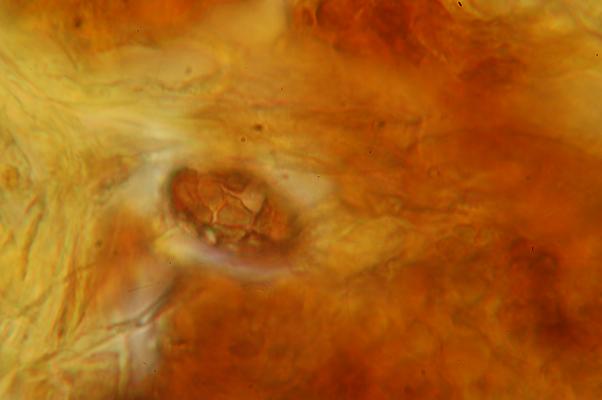 macrostoma
