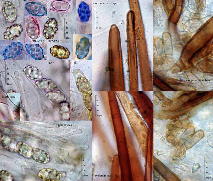 macrostoma