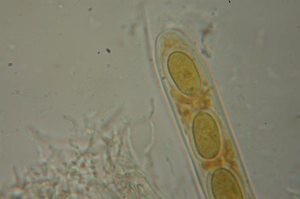 macrostoma