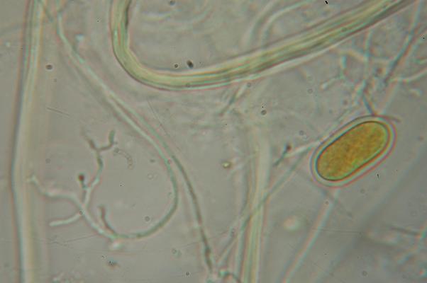 macrostoma