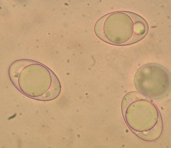 macrostoma