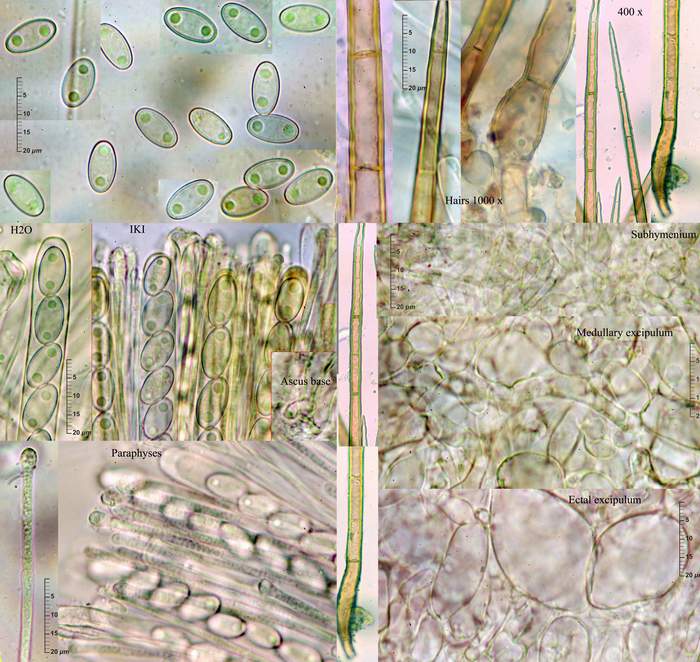 macrostoma